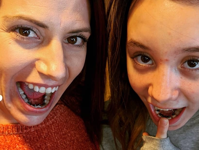 An adult and a teen laughing and showing the lingual braces on the inside of their teeth