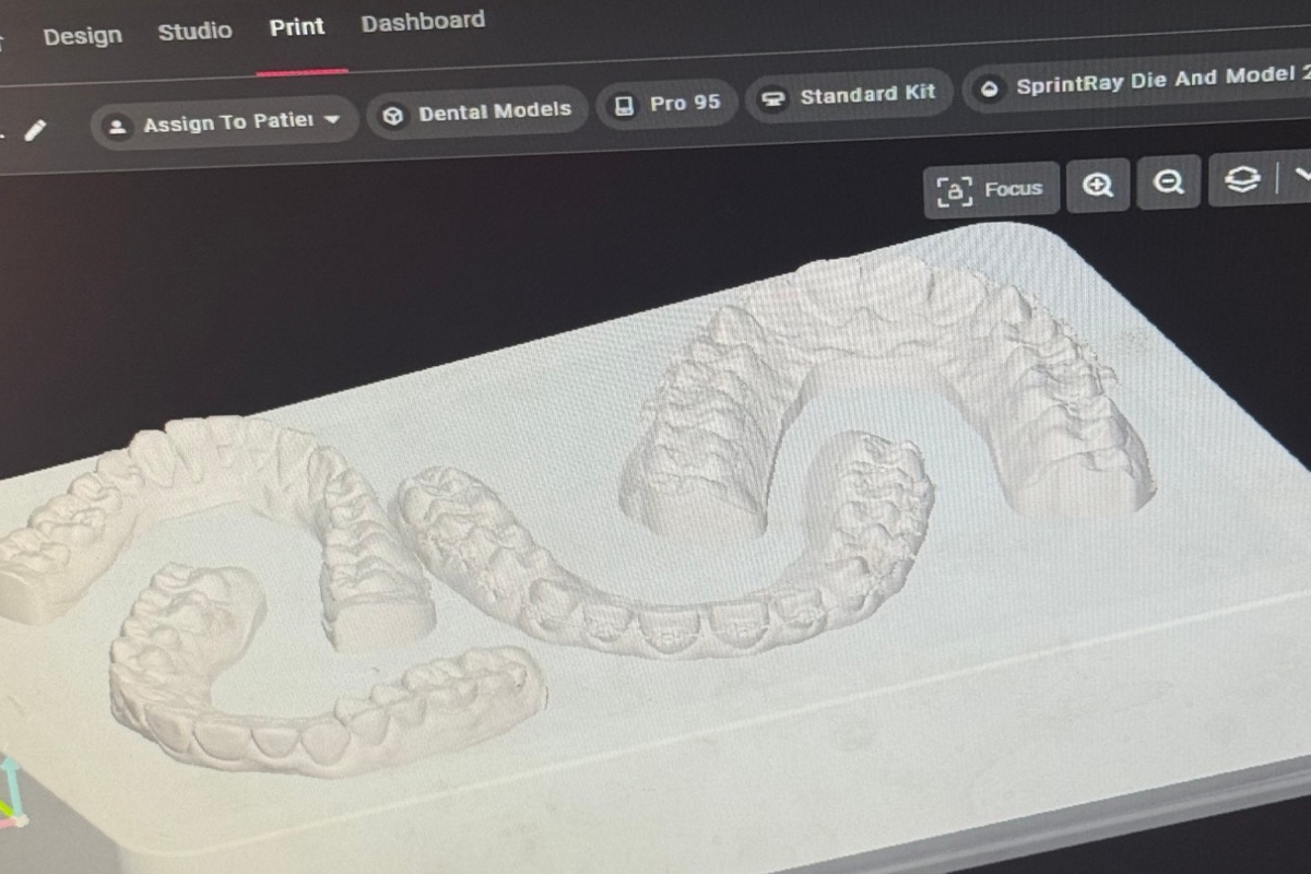 Dental models arranged on a virtual build plate in SprintRay's print software